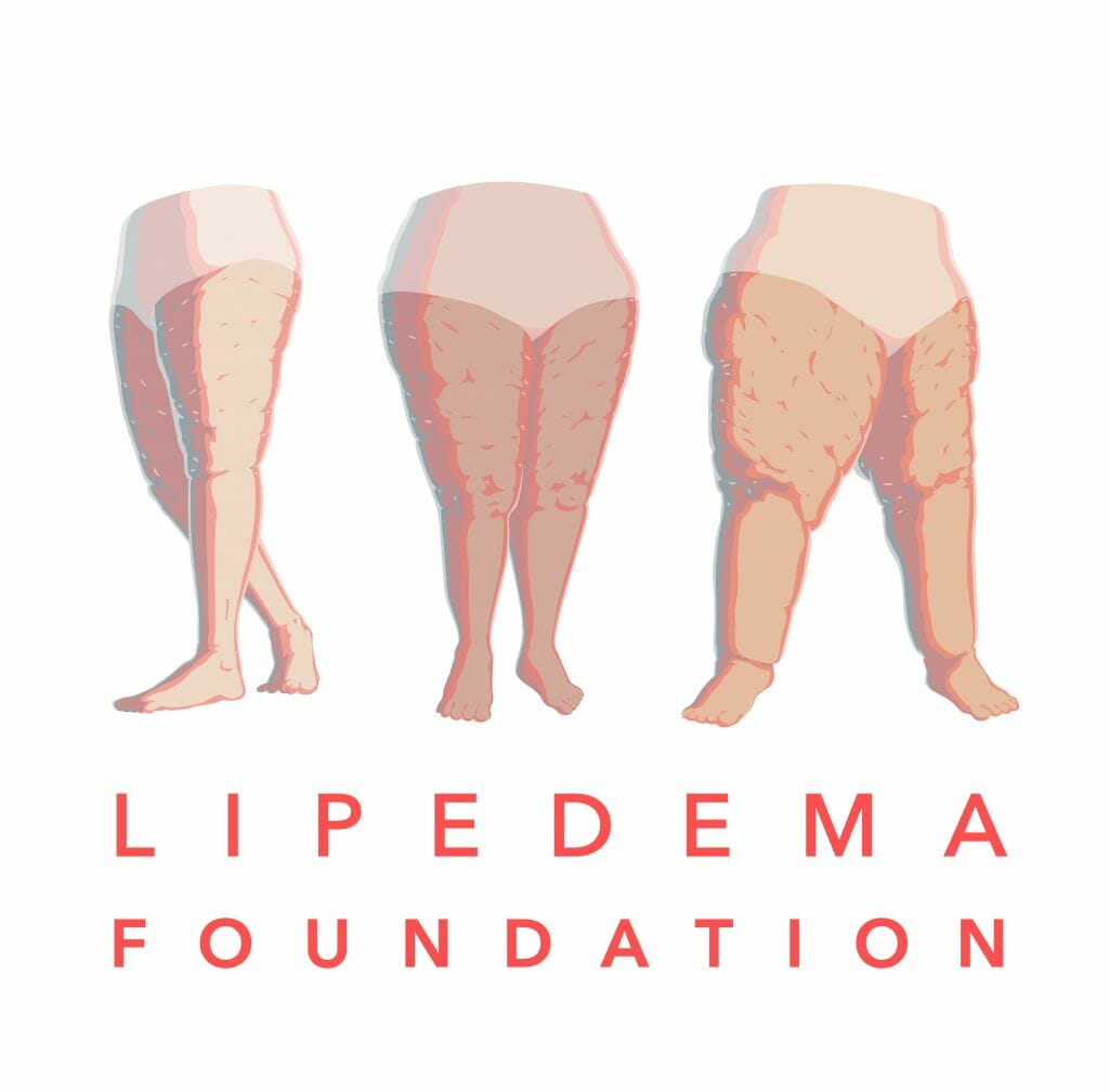 Lipedema Foundation