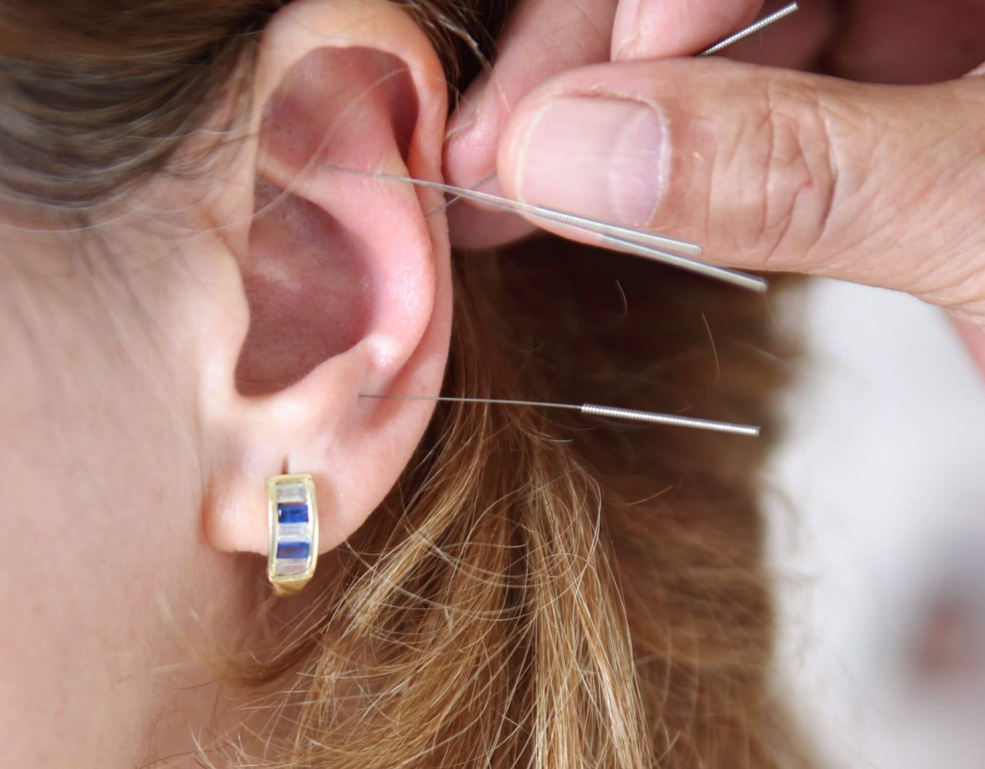 ACUPUNCTURISTS